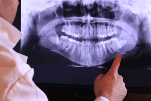 Best Emergency Wisdom Teeth Removal in South Uniontown, PA